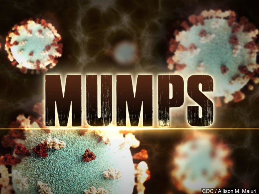 mumps generic