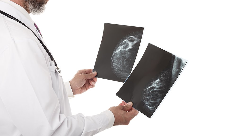 Doctor looking at a mammography isolated over white background copy space