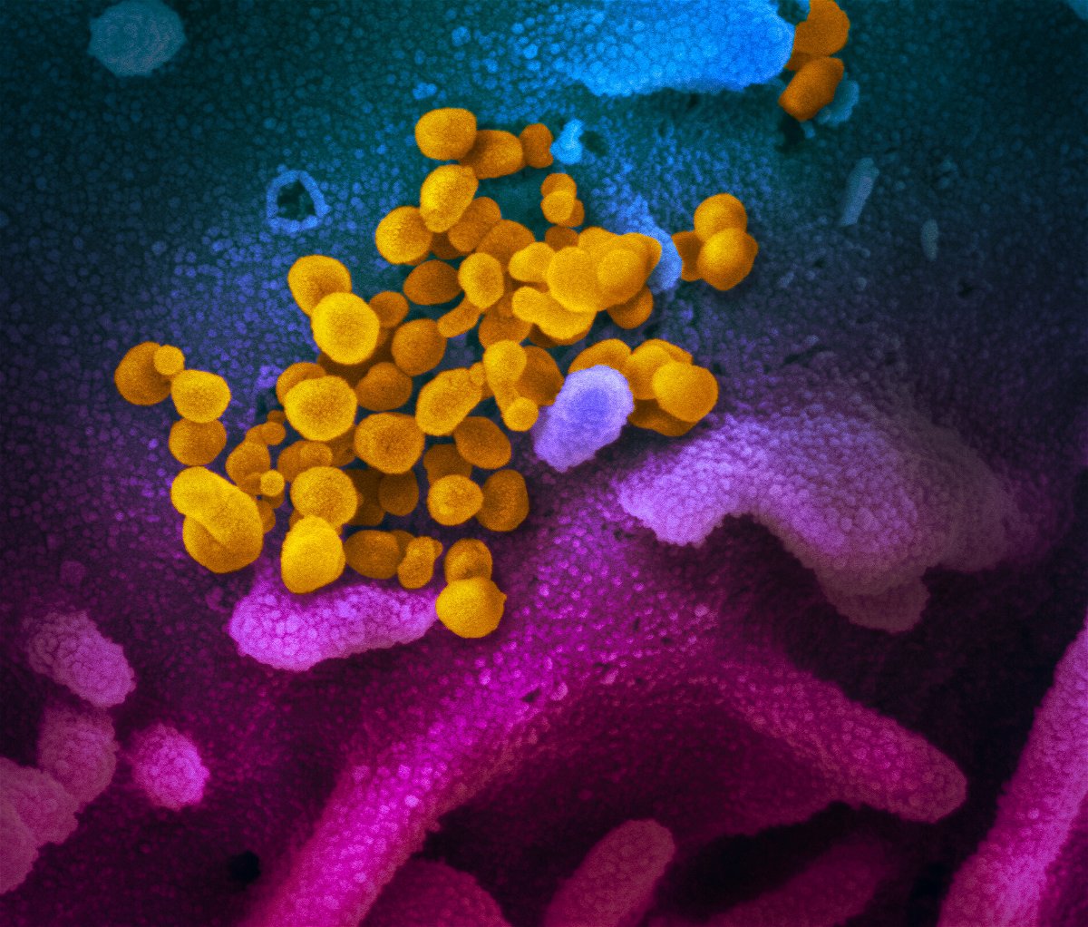 <i>NIAID-RML</i><br/>This scanning electron microscope image shows SARS-CoV-2 (yellow)—also known as 2019-nCoV