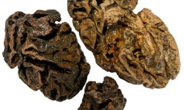 Fragments of brain from a person buried in a Victorian workhouse cemetery in Bristol