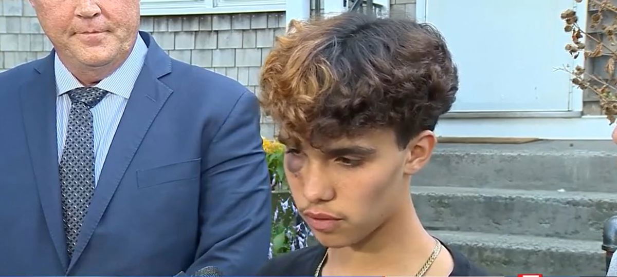 <i>WCVB via CNN Newsource</i><br/>Injured transgender teenager