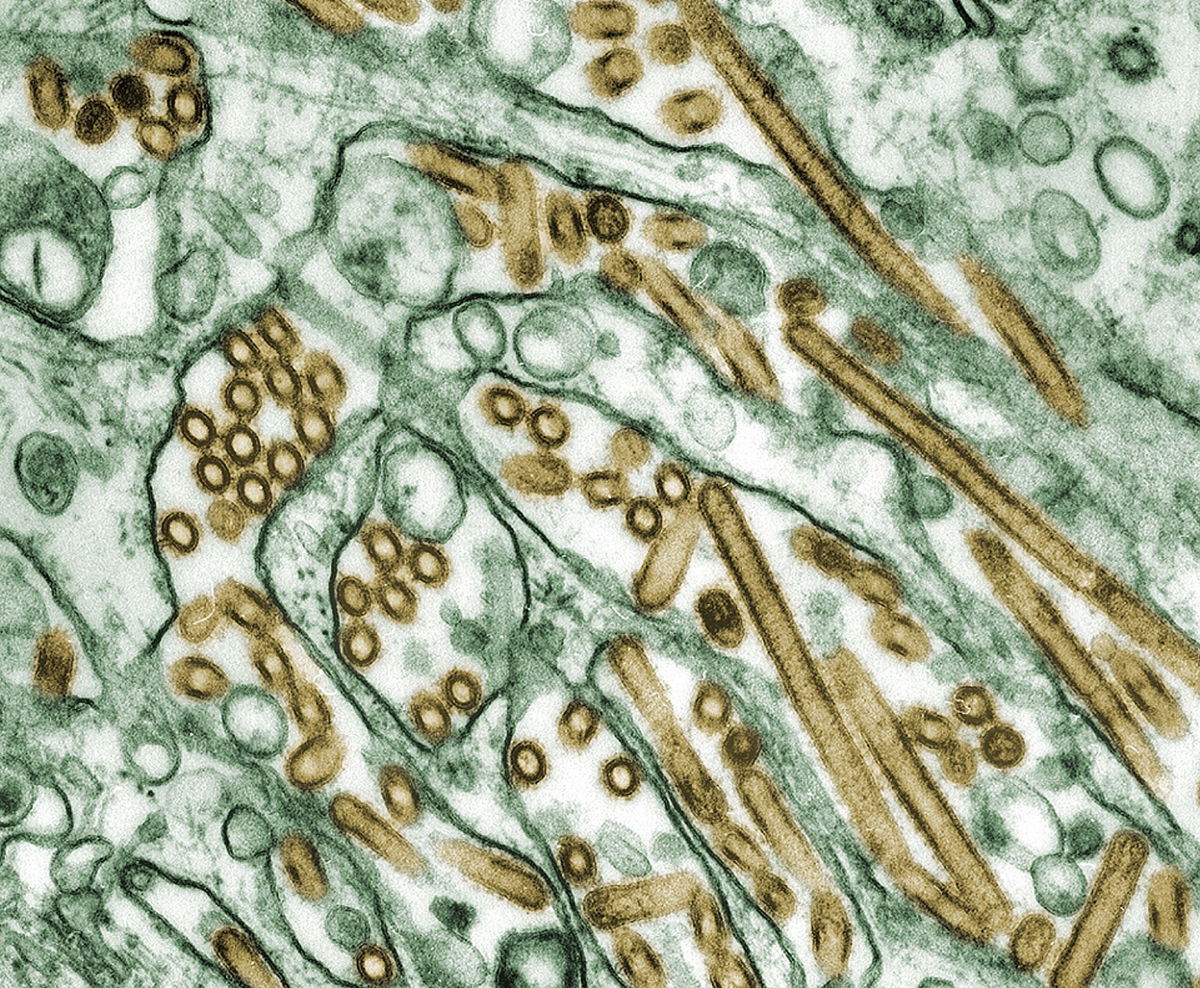 <i>Smith Collection/Gado/Getty Images via CNN Newsource</i><br/>Avian influenza A H5N1 viruses are pictured under an electron microscope.