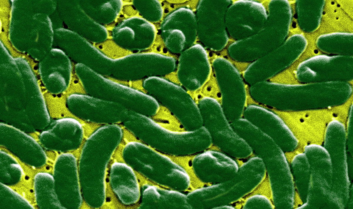 <i>BSIP/Getty Images via CNN Newsource</i><br/>Vibrio vulnificus bacteria can cause fatal infections.