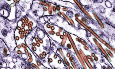 CDC testing will confirm whether the child had H5N1 bird flu.